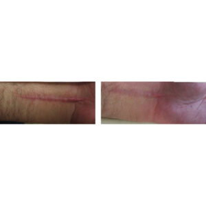 before-after